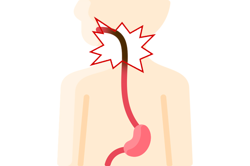 Very Sizzling Espresso Will increase Your Danger Of Esophageal Most cancers
